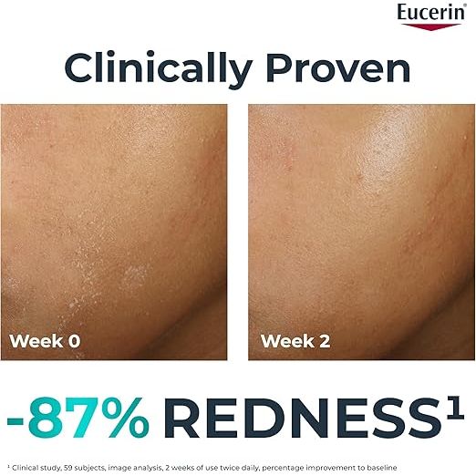 Eucerin - DermoPure Clinical Hydra Repair Fluid