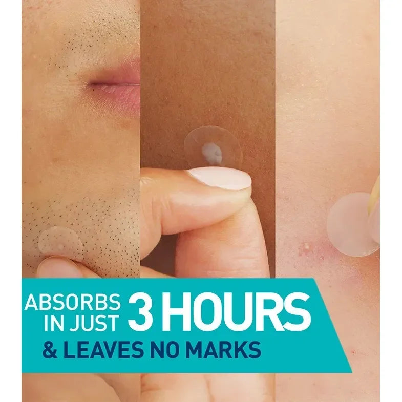 CeraVe - Blemish Barrier Patches (Acne Patches) - GOLDFARMACI