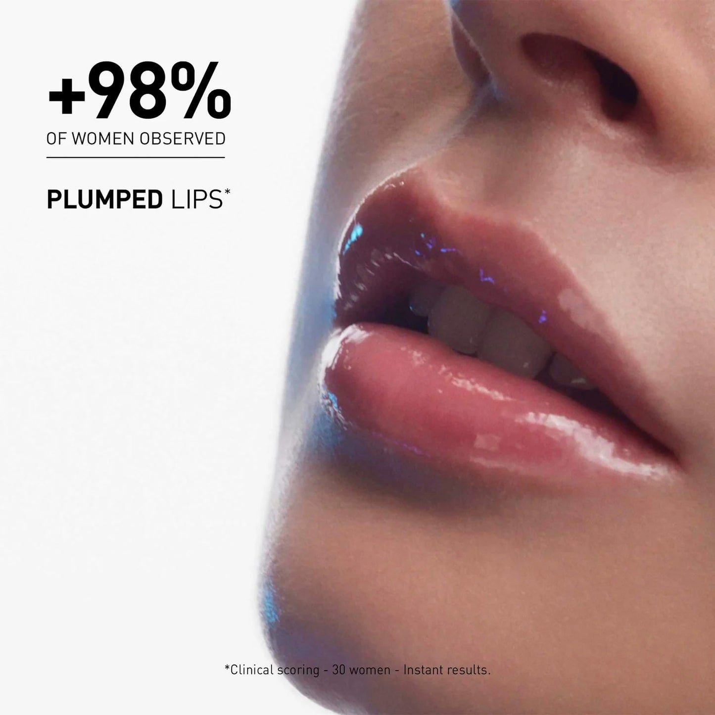 Filorga – Hyalu-Filler Lips