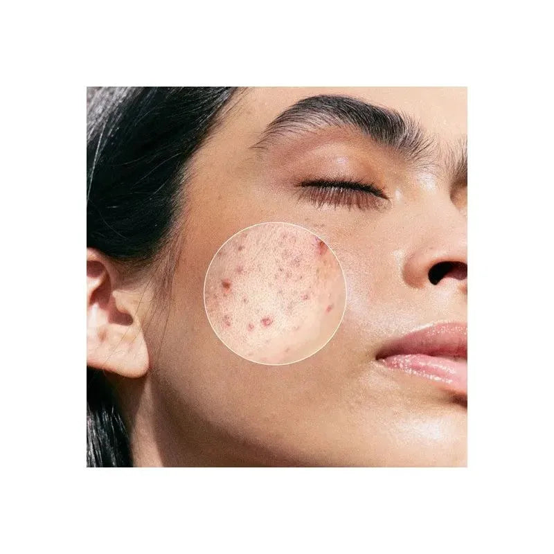 Janssen - Purifying BHA Serum - GOLDFARMACI