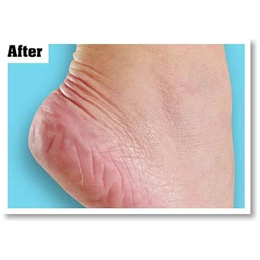 O'Keeffe's - Healthy Feet - GOLDFARMACI