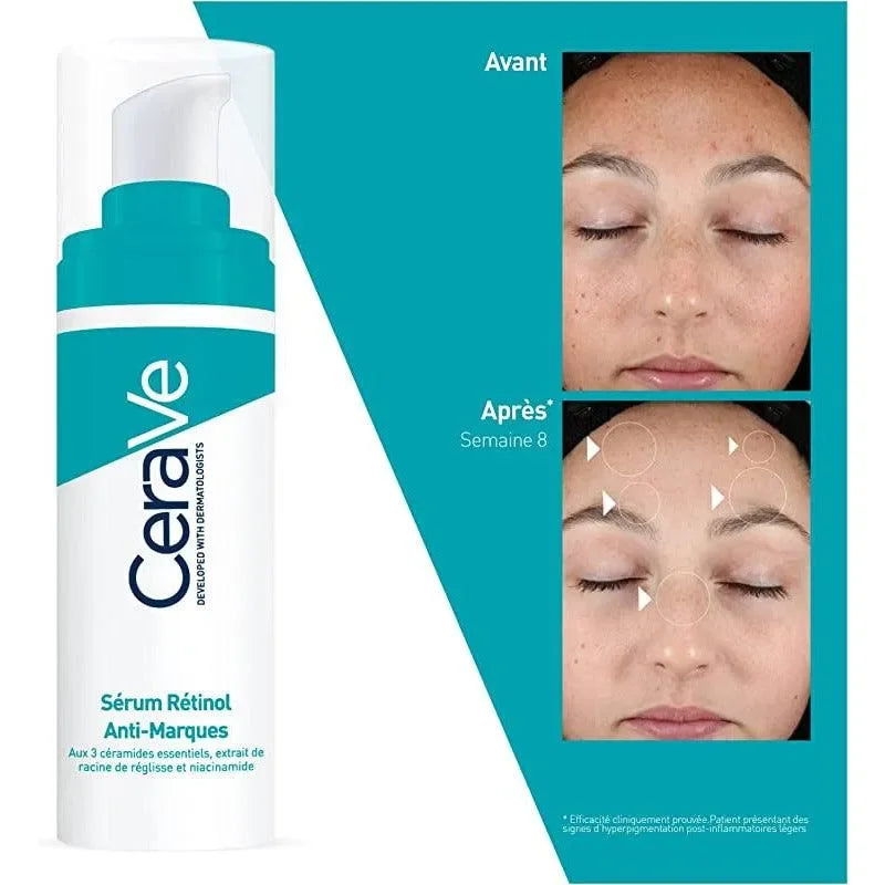 CeraVe Retinol Anti-Blemish Serum bottle with before and after close-ups of a woman's face showing visible skin improvement after 8 weeks.