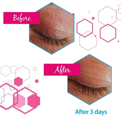 Ducray - Dexyane MeD Palpebral