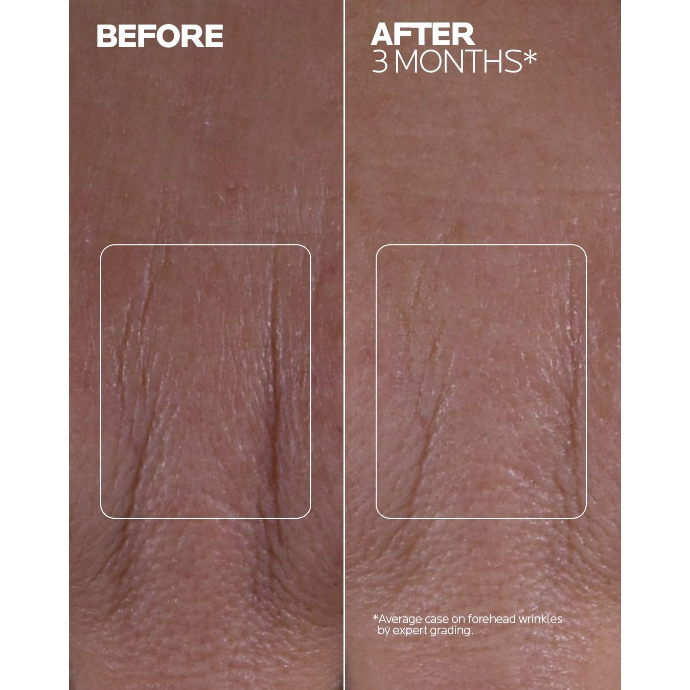 La Roche-Posay - Mela B3 Double Dose Day & Night Emulsion