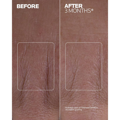La Roche-Posay - Mela B3 Double Dose Day & Night Emulsion