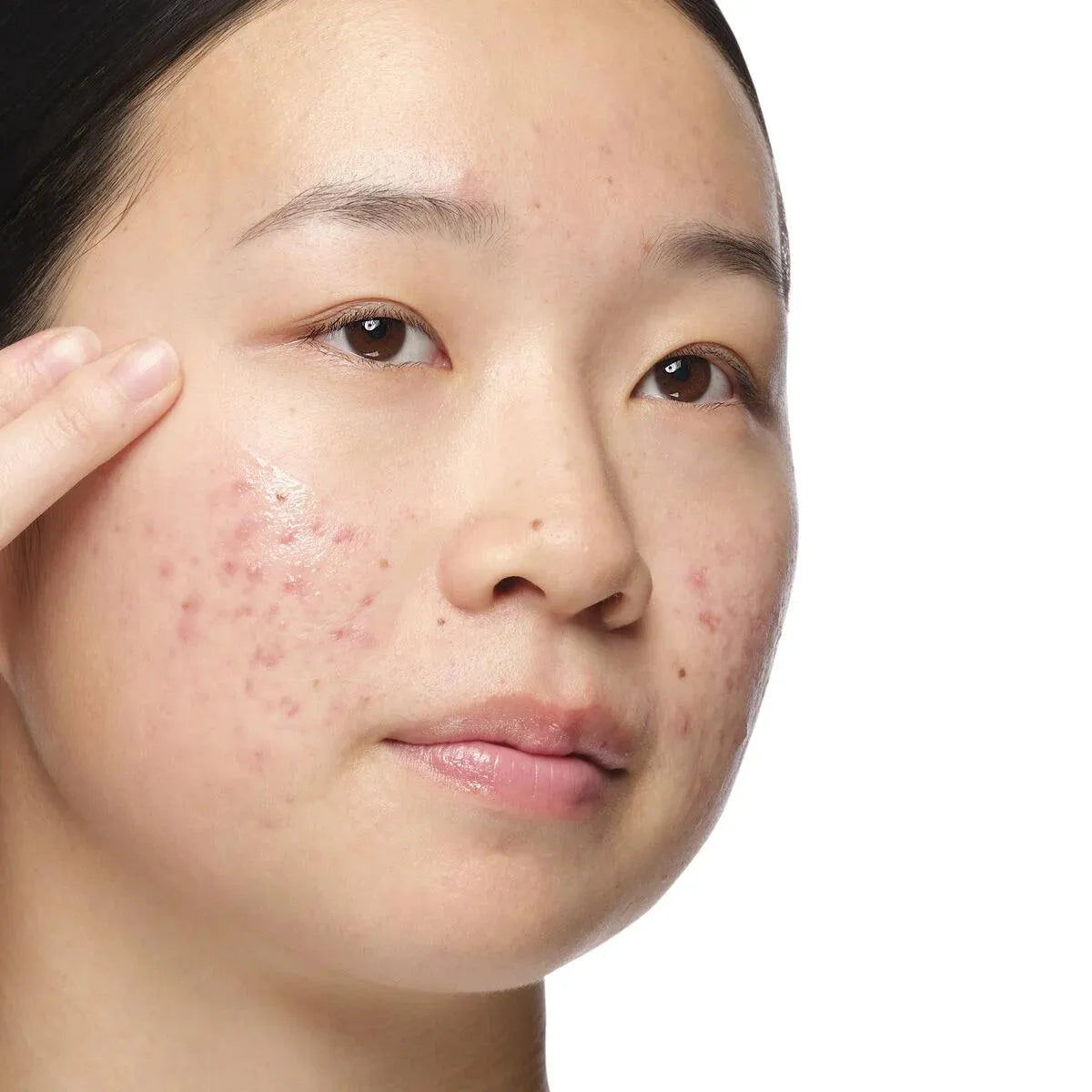 The Ordinary - Aloe 2% + NAG 2% Solution - GOLDFARMACI