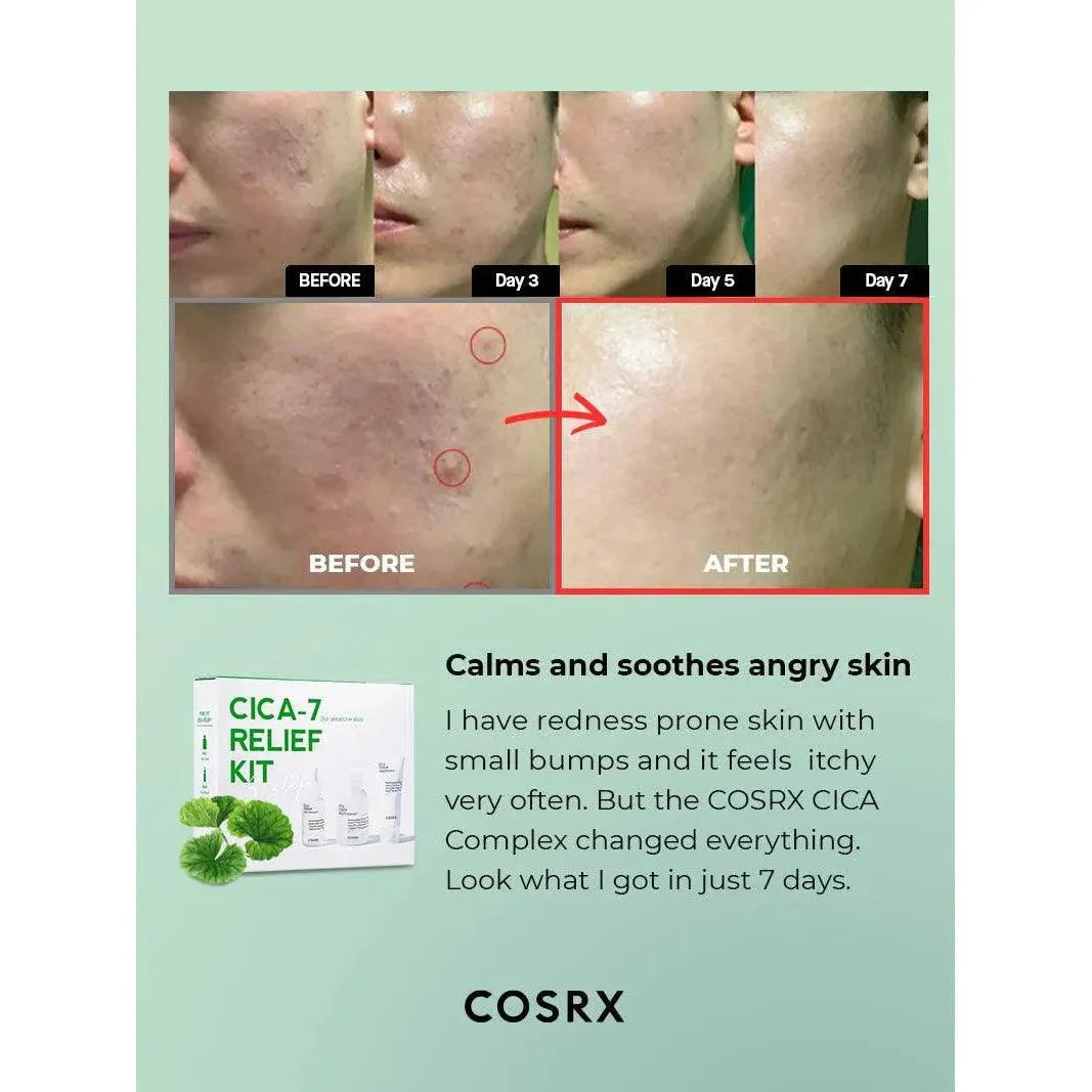 Cosrx - Pure Cica Relief Kit - GOLDFARMACI