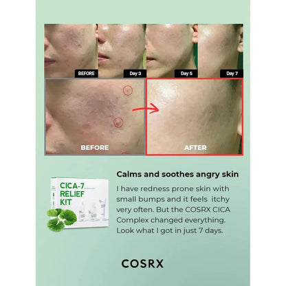 Cosrx - Pure Cica Relief Kit - GOLDFARMACI