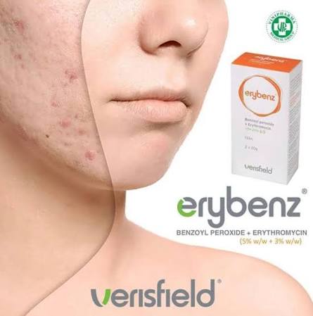 Erybenz Gel Benzoil peroksid + Eritromicinë (5+3)%