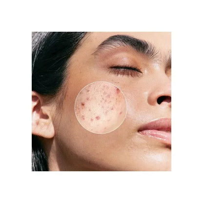 Janssen - Purifying BHA Serum - GOLDFARMACI