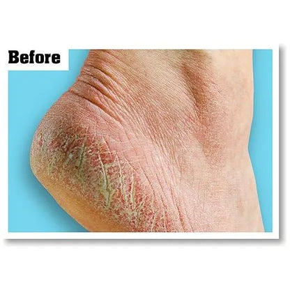 O'Keeffe's - Healthy Feet - GOLDFARMACI