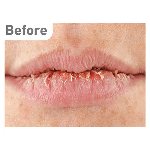 O'Keeffe's - Lip Repair - GOLDFARMACI