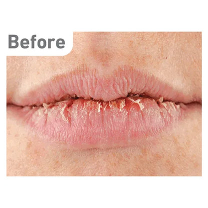 O'Keeffe's - Lip Repair - GOLDFARMACI