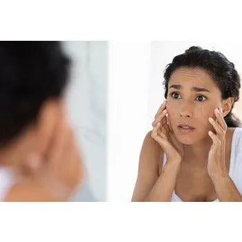 Frezyderm - Anticort Cream - GOLDFARMACI