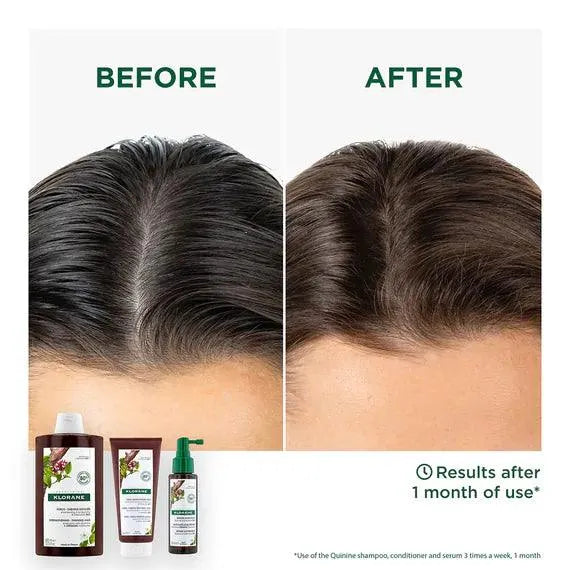 Klorane - Strengthening-Thinning Hair Conditioner with Quinine - GOLDFARMACI